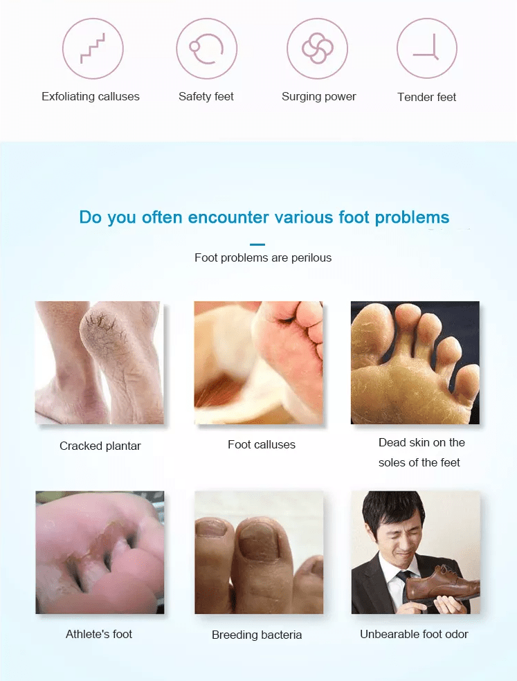 Elektrisk pedicure fod fil - Genopladelig via USB