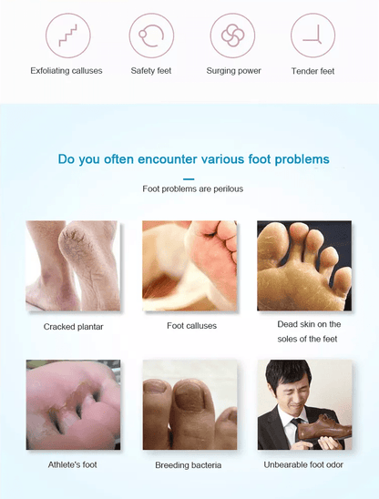 Elektrisk pedicure fod fil - Genopladelig via USB