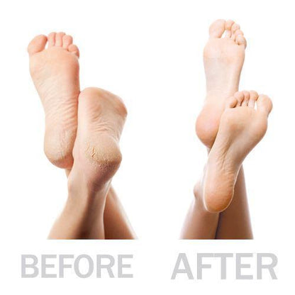 PediPro Deluxe Pedicure-sæt